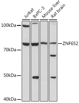 Western blot analysis of extracts of various cell lines, using ZNF652 antibody (TA383597) at 1:1000 dilution. - Secondary antibody: HRP Goat Anti-Rabbit IgG (H+L) at 1:10000 dilution. - Lysates/proteins: 25ug per lane. - Blocking buffer: 3% nonfat dry milk in TBST. - Detection: ECL Basic Kit . - Exposure time: 90s.
