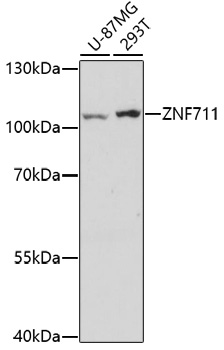 Western blot analysis of extracts of various cell lines, using ZNF711 antibody (TA383605) at 1:1000 dilution. - Secondary antibody: HRP Goat Anti-Rabbit IgG (H+L) at 1:10000 dilution. - Lysates/proteins: 25ug per lane. - Blocking buffer: 3% nonfat dry milk in TBST. - Detection: ECL Enhanced Kit . - Exposure time: 3min.
