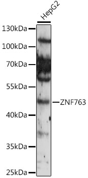 Western blot analysis of extracts of various cell lines, using ZNF763 antibody (TA383607) at 1:1000 dilution. - Secondary antibody: HRP Goat Anti-Rabbit IgG (H+L) at 1:10000 dilution. - Lysates/proteins: 25ug per lane. - Blocking buffer: 3% nonfat dry milk in TBST. - Detection: ECL Enhanced Kit . - Exposure time: 10s.