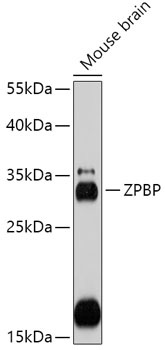 Western blot analysis of extracts of Mouse brain, using ZPBP antibody (TA383621) at 1:1000 dilution. - Secondary antibody: HRP Goat Anti-Rabbit IgG (H+L) at 1:10000 dilution. - Lysates/proteins: 25ug per lane. - Blocking buffer: 3% nonfat dry milk in TBST. - Detection: ECL Basic Kit . - Exposure time: 30s.