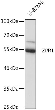 Western blot analysis of extracts of U-87MG cells, using ZPR1 antibody (TA383622) at 1:1000 dilution. - Secondary antibody: HRP Goat Anti-Rabbit IgG (H+L) at 1:10000 dilution. - Lysates/proteins: 25ug per lane. - Blocking buffer: 3% nonfat dry milk in TBST. - Detection: ECL Basic Kit . - Exposure time: 30s.