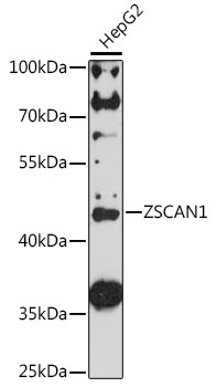 Western blot analysis of extracts of HepG2 cells, using ZSCAN1 antibody (TA383624) at 1:1000 dilution. - Secondary antibody: HRP Goat Anti-Rabbit IgG (H+L) at 1:10000 dilution. - Lysates/proteins: 25ug per lane. - Blocking buffer: 3% nonfat dry milk in TBST. - Detection: ECL Enhanced Kit . - Exposure time: 90s.