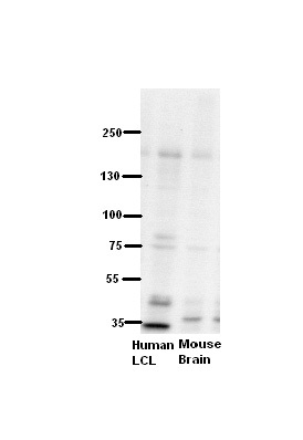 WB Suggested Anti-ZNF294 Antibody Titration: 5% Milk ELISA Titer: dilution: 1:500 Positive Control: human LCL and mouse brains