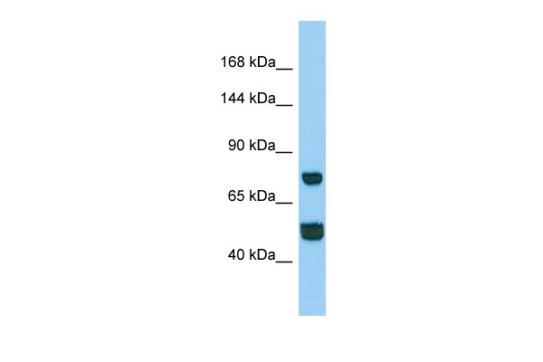 Host: Rabbit Target Name: CCDC39 Sample Type: Hela Whole cell lysates Antibody Dilution: 1.0ug/ml