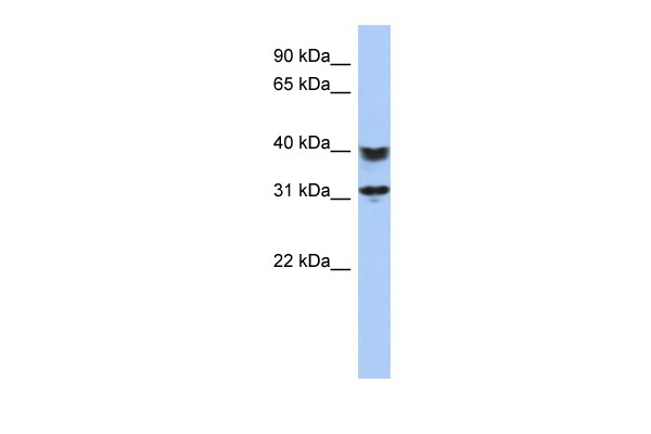 WB Suggested Anti-C5orf35 Antibody Titration: 0.2-1 ug/ml ELISA Titer: 1:1562500 Positive Control: Jurkat cell lysate