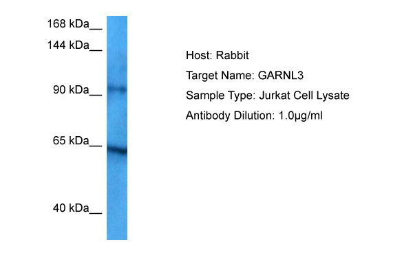 Host: Rabbit Target Name: GARNL3 Sample Tissue: Jurkat Whole Cell lysates Antibody Dilution: 1ug/ml