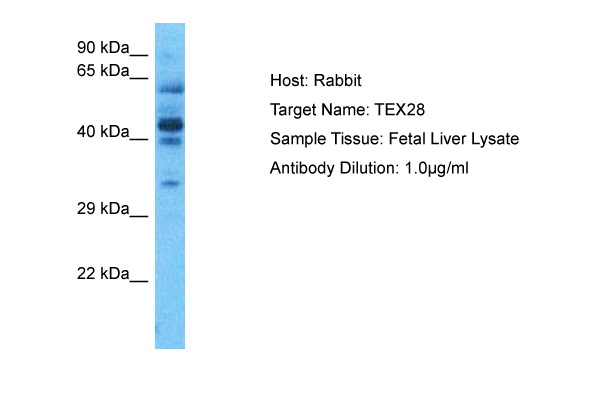 Host: Rabbit Target Name: TEX28 Sample Type: Fetal Liver Antibody Dilution: 1.0ug/ml
