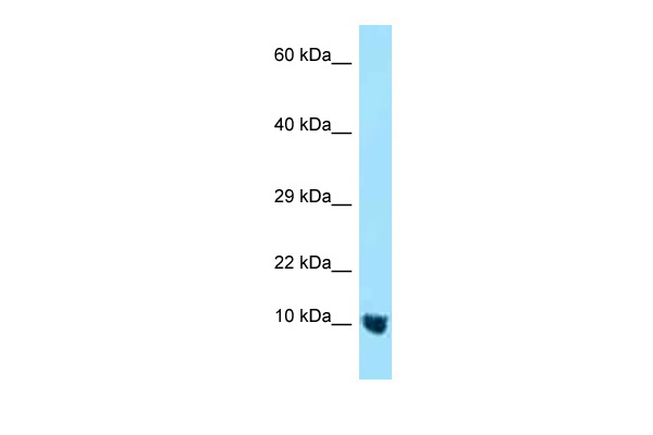 WB Suggested Anti-MTCP1NB Antibody Titration: 1.0 ug/ml Positive Control: 293T Whole CellCMC4 is strongly supported by BioGPS gene expression data to be expressed in Human HEK293T cells