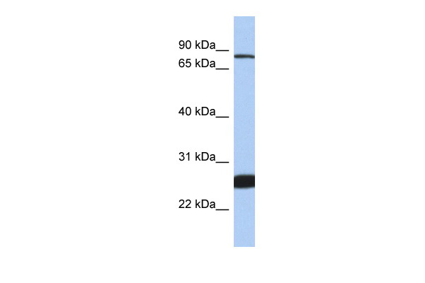 WB Suggested Anti-NFE2L1 Antibody Titration: 1.0 ug/ml Positive Control: THP-1 Whole Cell