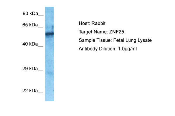 Host: Rabbit Target Name: ZNF25 Sample Type: Fetal Lung lysates Antibody Dilution: 1.0ug/ml