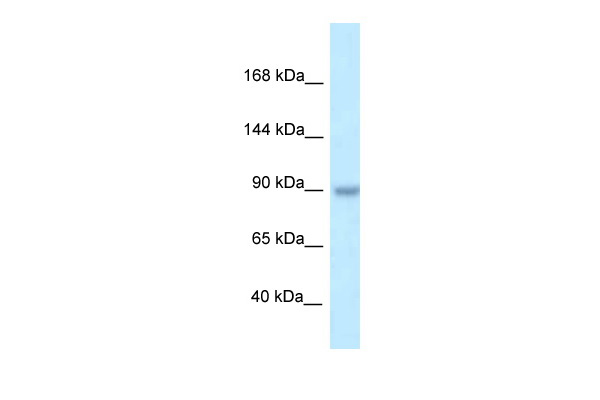 WB Suggested Anti-TBC1D2B Antibody Titration: 1.0 ug/ml Positive Control: PANC1 Whole CellTBC1D2B is strongly supported by BioGPS gene expression data to be expressed in Human PANC1 cells