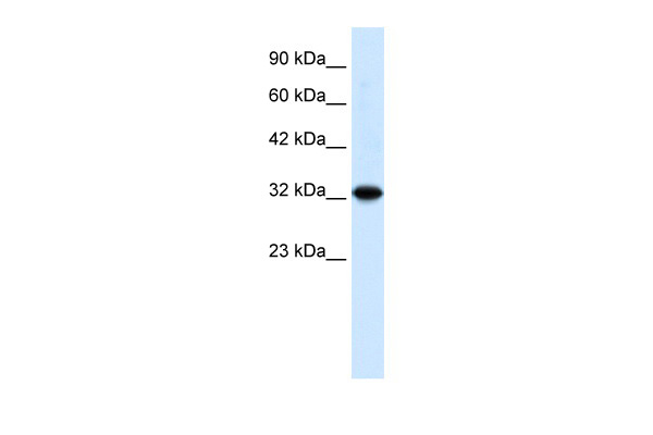 WB Suggested Anti-ZBTB32 Antibody Titration: 0.2-1 ug/ml ELISA Titer: 1:2500 Positive Control: HepG2 cell lysate