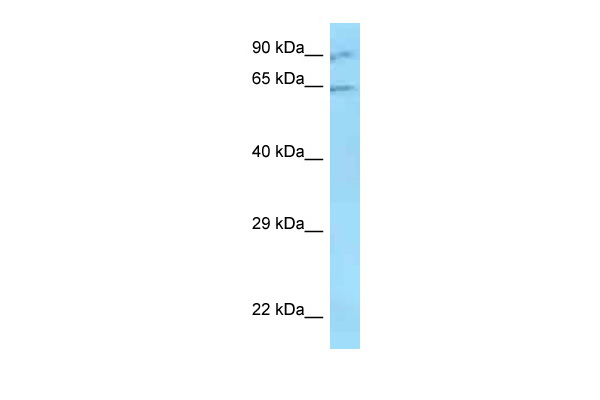 WB Suggested Anti-ZNF280B Antibody Titration: 1.0 ug/ml Positive Control: ACHN Whole Cell