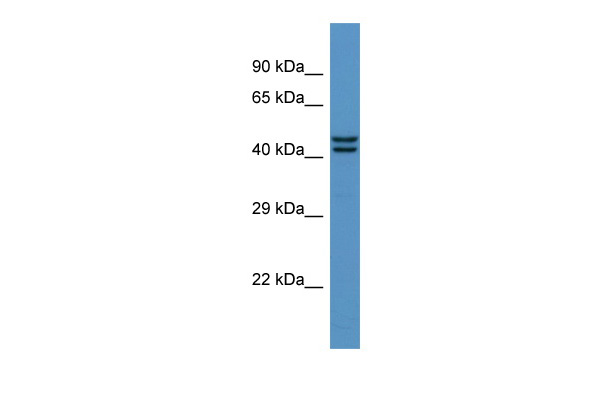 Western blot analysis of extracts from normal (control) and BAF57/SMARCE1 knockout (KO) 293T cells, using BAF57/SMARCE1 antibody (TA381767) at 1:1000 dilution.|Secondary antibody: HRP Goat Anti-Rabbit IgG (H+L) at 1:10000 dilution.|Lysates/proteins: 25ug per lane.|Blocking buffer: 3% nonfat dry milk in TBST.|Detection: ECL Enhanced Kit .|Exposure time: 180s.