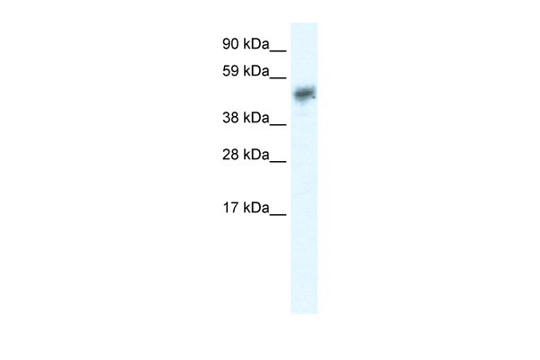 Western blot analysis of extracts of various cell lines, using Phospho-SMC1-S957 antibody (TA381769) at 1:1000 dilution. HeLa and NIH/3T3 cells were treated by UV for 15-30 minutes.|Secondary antibody: HRP Goat Anti-Rabbit IgG (H+L) at 1:10000 dilution.|Lysates/proteins: 25ug per lane.|Blocking buffer: 3% BSA.|Detection: ECL Basic Kit .|Exposure time: 3s.