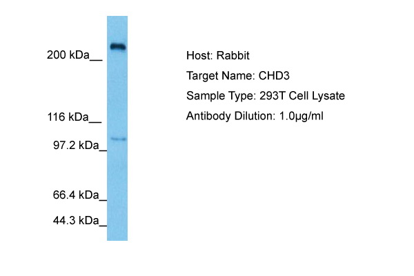 Host: Rabbit Target Name: CHD3 Sample Tissue: Human 293T Whole Cell lysates Antibody Dilution: 3ug/ml