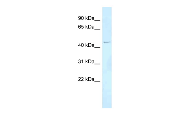 WB Suggested Anti-FOXN2 Antibody Titration: 1.0 ug/ml Positive Control: COLO205 Whole Cell