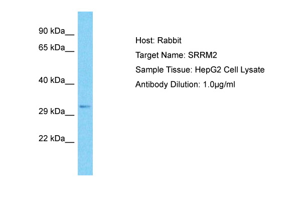 Host: Rabbit Target Name: SRRM2 Sample Type: HepG2 Whole Cell lysates Antibody Dilution: 1.0ug/ml