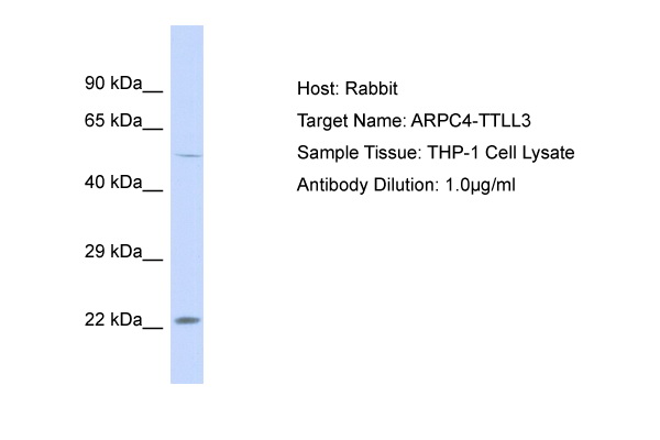 Western blot analysis of extracts from normal (control) and SND1 Rabbit pAb knockout (KO) HeLa cells, using SND1 Rabbit pAb antibody (TA381829) at 1:3000 dilution.|Secondary antibody: HRP Goat Anti-Rabbit IgG (H+L) at 1:10000 dilution.|Lysates/proteins: 25ug per lane.|Blocking buffer: 3% nonfat dry milk in TBST.|Detection: ECL Basic Kit .|Exposure time: 1s.