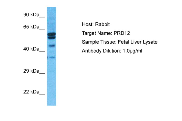 Host: Rabbit Target Name: PRD12 Sample Type: Fetal Liver lysates Antibody Dilution: 1.0ug/ml