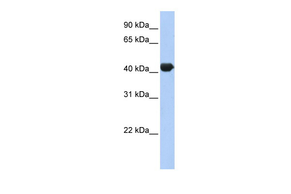 WB Suggested Anti-ZNF3 Antibody Titration: 0.2-1 ug/ml Positive Control: Human Muscle