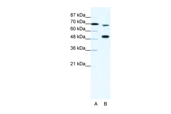 WB Suggested Anti-MLL4 Antibody Titration: 5ug/ml Positive Control: HepG2 cell lysateKMT2B is strongly supported by BioGPS gene expression data to be expressed in Human HepG2 cells