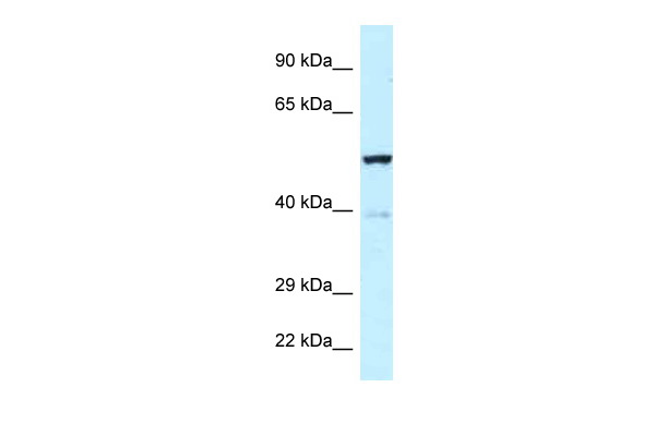 WB Suggested Anti-Trp63 Antibody Titration: 1.0 ug/ml Positive Control: Mouse heart