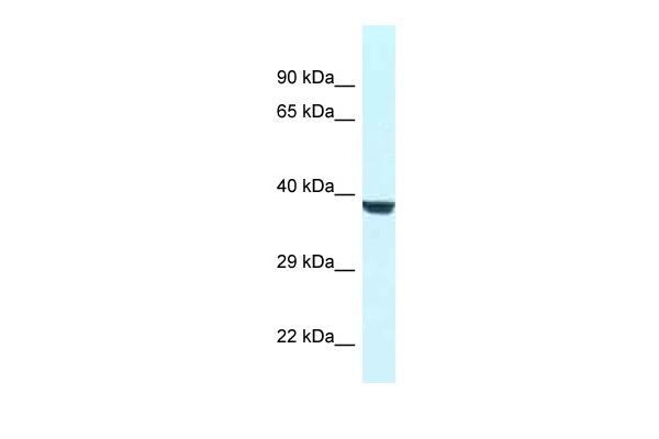 WB Suggested Anti-Wdr45l Antibody Titration: 1.0 ug/ml Positive Control: Rat Liver