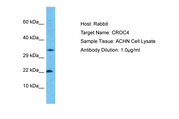 Western blot analysis of extracts of normal 293T cells and 293T transfected with Spike S2 Protein, using SARS-CoV-2 Spike S2 antibody (TA381942) at 1:1000 dilution.|Secondary antibody: HRP Goat Anti-Rabbit IgG (H+L) at 1:10000 dilution.|Lysates/proteins: 25ug per lane.|Blocking buffer: 3% nonfat dry milk in TBST.|Detection: ECL Basic Kit .|Exposure time: 5s.