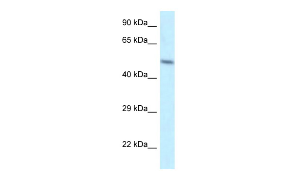 WB Suggested Anti-ZFP2 Antibody Titration: 1.0 ug/ml Positive Control: Hela Whole Cell