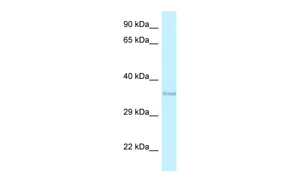 WB Suggested Anti-RNF135 Antibody Titration: 1.0 ug/ml Positive Control: HepG2 Whole Cell