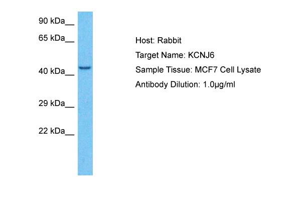 Host: Rabbit Target Name: KCNJ6 Sample Type: MCF7 Whole Cell lysates Antibody Dilution: 1.0ug/ml