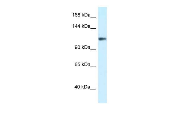 WB Suggested Anti-KCNH3 Antibody Titration: 1.0 ug/ml Positive Control: COLO205 Whole Cell