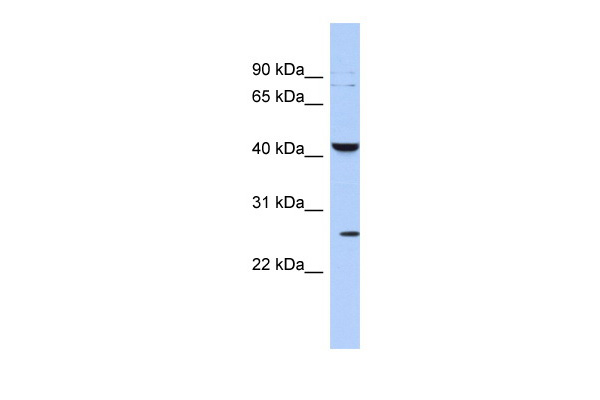 WB Suggested Anti-KCNMB4 Antibody Titration: 0.2-1 ug/ml ELISA Titer: 1:312500 Positive Control: THP-1 cell lysate