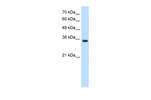 WB Suggested Anti-TRPM5 Antibody Titration: 1.25ug/ml ELISA Titer: 1:1562500 Positive Control: HepG2 cell lysate