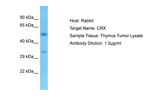 Host: Rabbit Target Name: CRX Sample Type: Thymus Tumor lysates Antibody Dilution: 1.0ug/ml