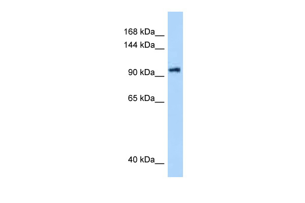 WB Suggested Anti-DHX16 Antibody Titration: 0.25 ug/ml Positive Control: PANC1 Whole Cell