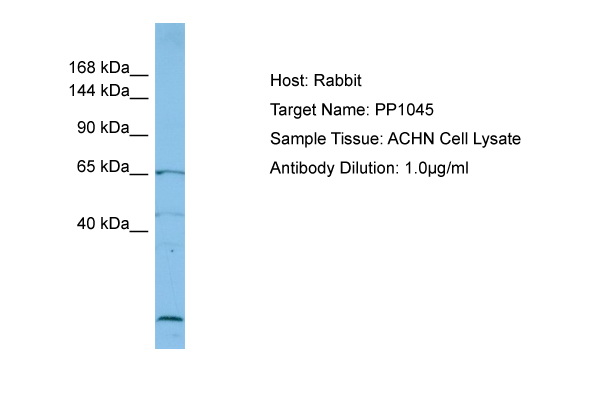 Host: Rabbit Target Name: PP1045 Sample Type: ACHN Whole Cell lysates Antibody Dilution: 1.0ug/ml