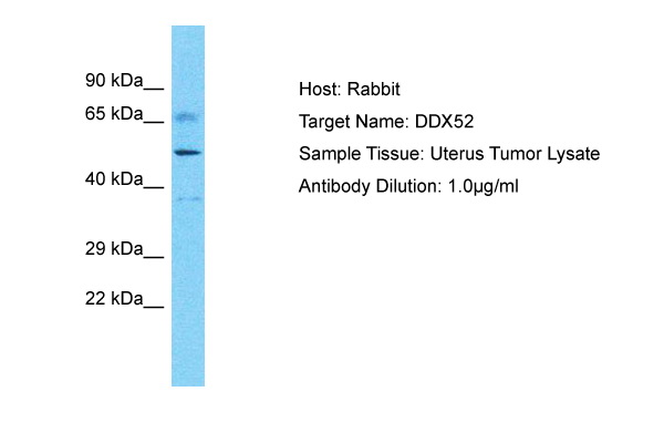 Host: Rabbit Target Name: DDX52 Sample Type: Uterus tumor lysates Antibody Dilution: 1.0ug/ml