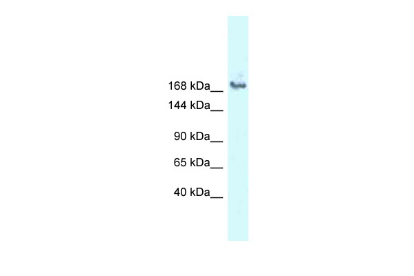 WB Suggested Anti-SNRNP200 Antibody Titration: 1.0 ug/ml Positive Control: COLO205 Whole Cell