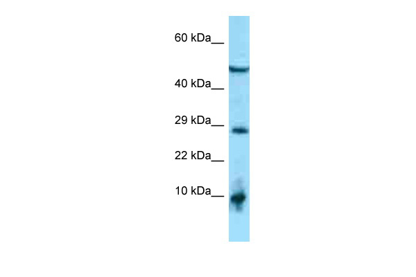 WB Suggested Anti-C2orf28 Antibody Titration: 1.0 ug/ml Positive Control: THP-1 Whole Cell