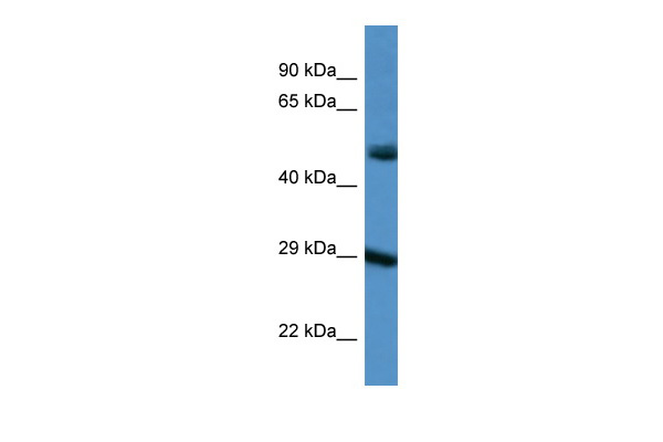 WB Suggested Anti-GJD3 Antibody Titration: 1.0 ug/ml Positive Control: 293T Whole Cell