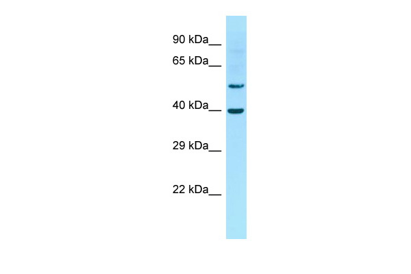 Host: Rabbit Target Name: Gja10 Sample Type: Rat Thymus lysates Antibody Dilution: 1.0ug/ml
