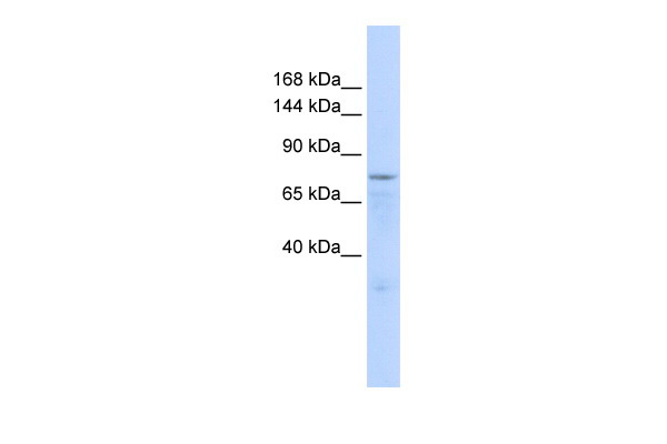 WB Suggested Anti-ZFP62 Antibody Titration: 0.2-1 ug/ml ELISA Titer: 1:312500 Positive Control: 293T cell lysate