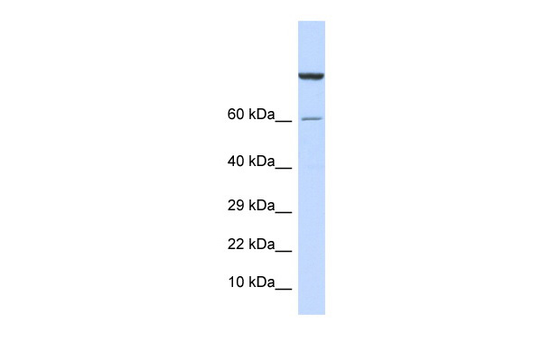 WB Suggested Anti-ZNF251 Antibody Titration: 0.2-1 ug/ml ELISA Titer: 1:1562500 Positive Control: Human Muscle