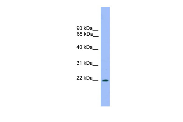 WB Suggested Anti-Prrxl1 Antibody Titration: 0.2-1 ug/ml ELISA Titer: 1:62500 Positive Control: Mouse Liver