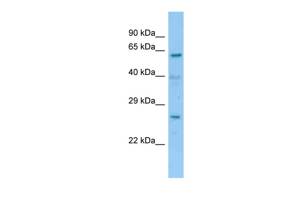 WB Suggested Anti-2700060E02Rik Antibody Titration: 1.0 ug/ml Positive Control: Mouse Liver