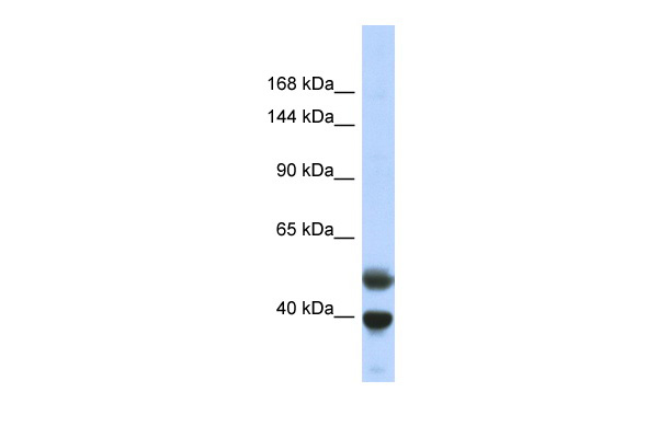 Host: Rabbit Target Name: PRDM7 Sample Type: Fetal Lung lysates Antibody Dilution: 1.0ug/ml
