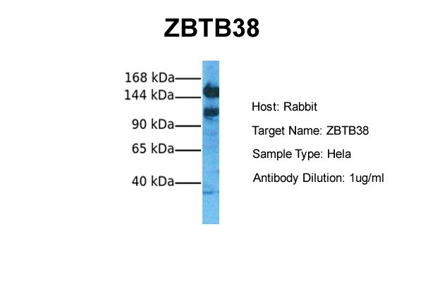 Host: Rabbit Target Name: ZBTB38 Sample Tissue: Human Hela Antibody Dilution: 1.0ug/ml