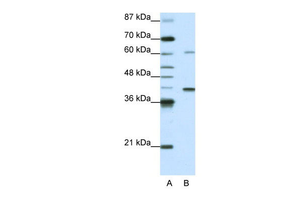 WB Suggested Anti-MGC46336 Antibody Titration: 0.2-1 ug/ml ELISA Titer: 1:1562500 Positive Control: HepG2 cell lysate